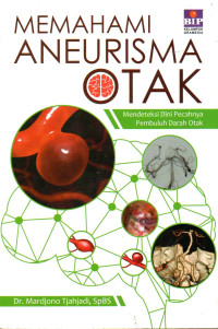Image of Memahami Aneurisma Otak